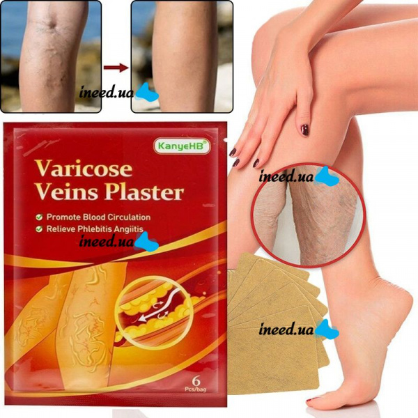 Пластырь от варикоза KanyeHB Varicose Veins Plaster
